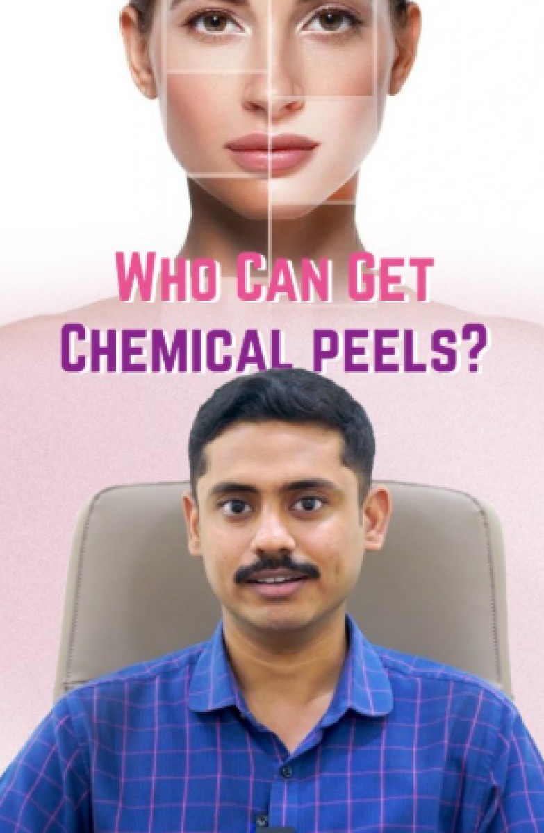 who can get chemical peel