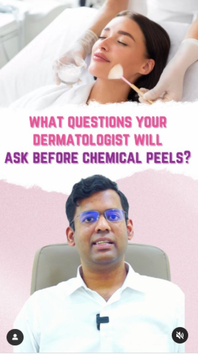 Thinking about getting a chemical peel?