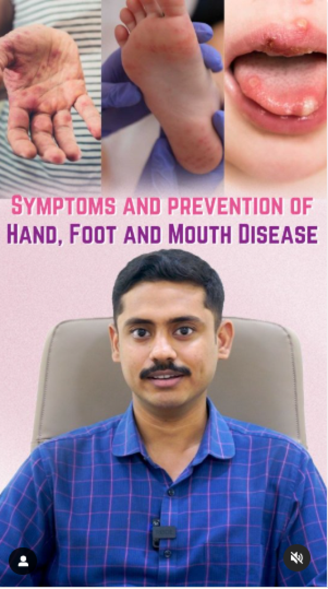 Symptoms and Prevention of Hand, Foot And Mouth Disease