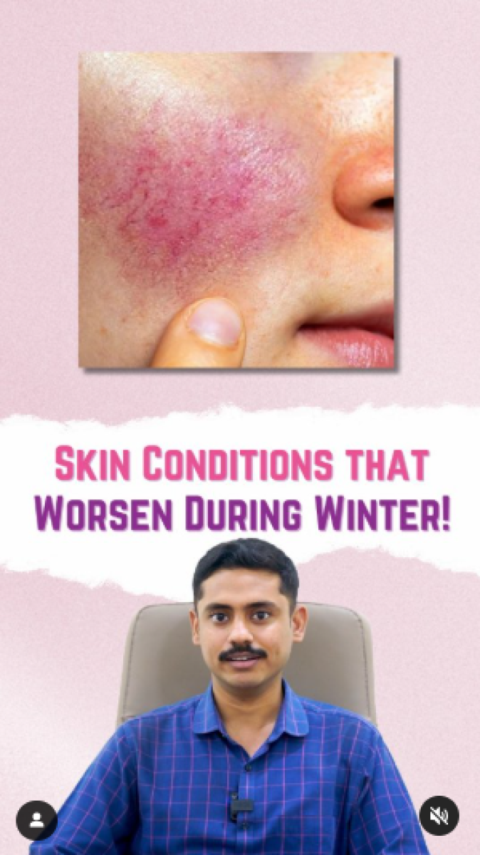 Skin Conditions that Worsen During Winter!