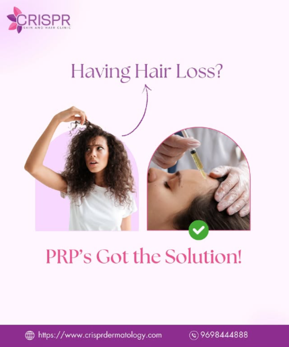 Hair Loss? PRP’s Got the Solution!