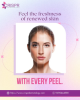 Reveal Fresh, Radiant Skin with Every Peel!